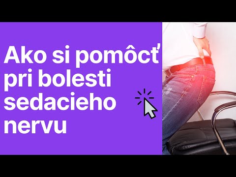 Video: Zápal (neuralgia) Sedacieho Nervu - Príčiny, Príznaky, Liečba, Kde To Je?