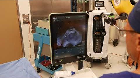 prostate biopsy looking for prostate cancer