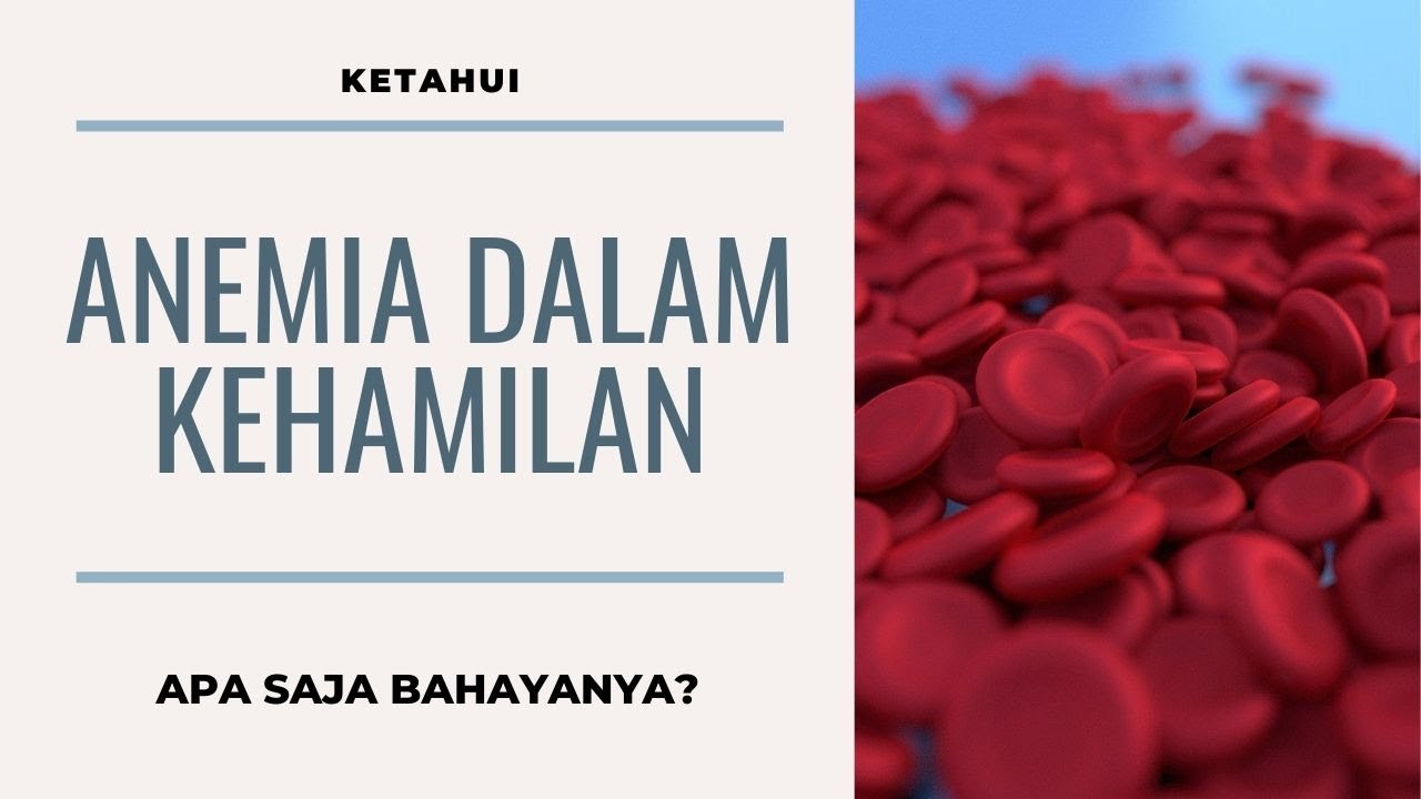 BAHAYA ANEMIA PADA IBU HAMIL