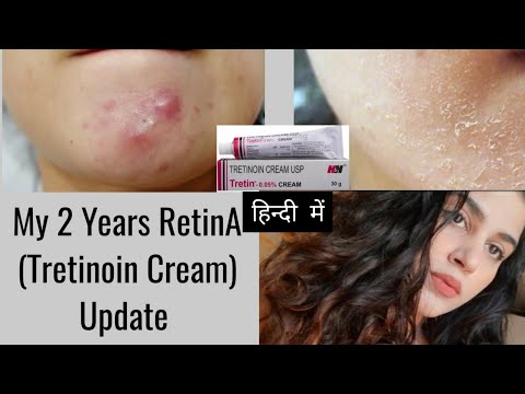 ट्रेटिनाॅइन क्रीम|Tretinoin Cream Review| Retino A Cream for Skin #tretinoincream #2yearsupdate