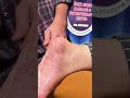 cupping #relax #painrehabb #massage #trending #cuppingmassage #cupping #foot #footmassage #heelpain
