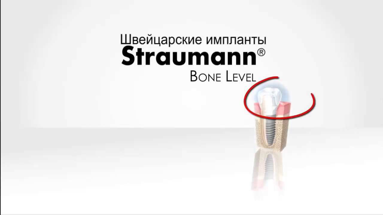 Имплант швейцария Имплант швейцария