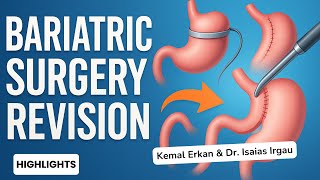 Bariatric Friday Premiere: Bariatric Surgery Revision