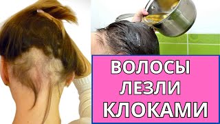 Этот ОТВАР ИЗБАВИТ ОТ ВЫПАДЕНИЯ ВОЛОС Очень быстро ! / ВОЛОСЫ СТАЛИ ГУЩЕ в тысячу  раз!