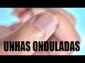 7 cuidados básicos para evitar unhas onduladas