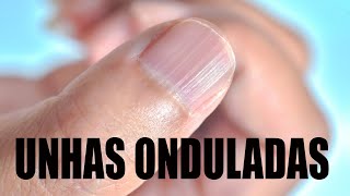 7 cuidados básicos para evitar unhas onduladas