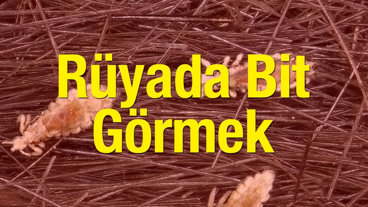 Ruyada Bit Gormek Nasil Yorumlanir Sacta Bit Gormenin Anlami Nedir Yasam Haberleri