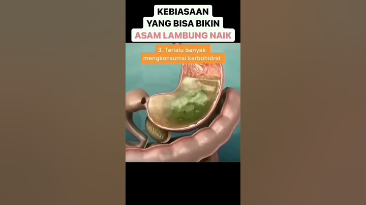Penyebab asam lambung naik | Kebiasaan mana yang tidak bisa dihindari?