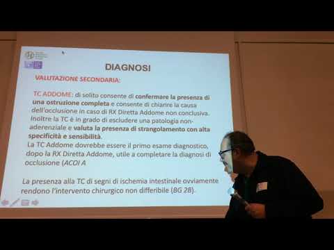 Video: Quanto tempo ci vuole per la risoluzione del pneumoperitoneo?