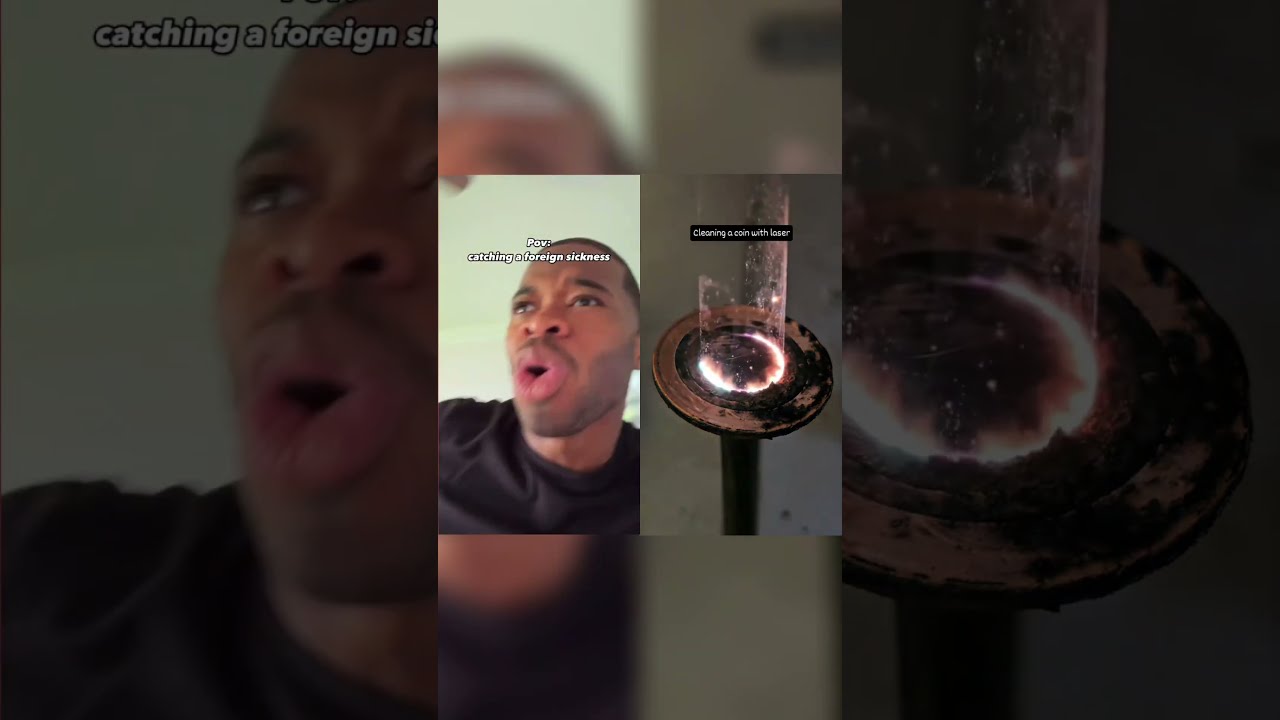 Catching A Foreign Sickness Funny Relatable