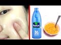 Skin Whitening Coconut oil Facial | Get Fair, Glowing, Spotless Skin Permanently ! Pure Beauty Tips