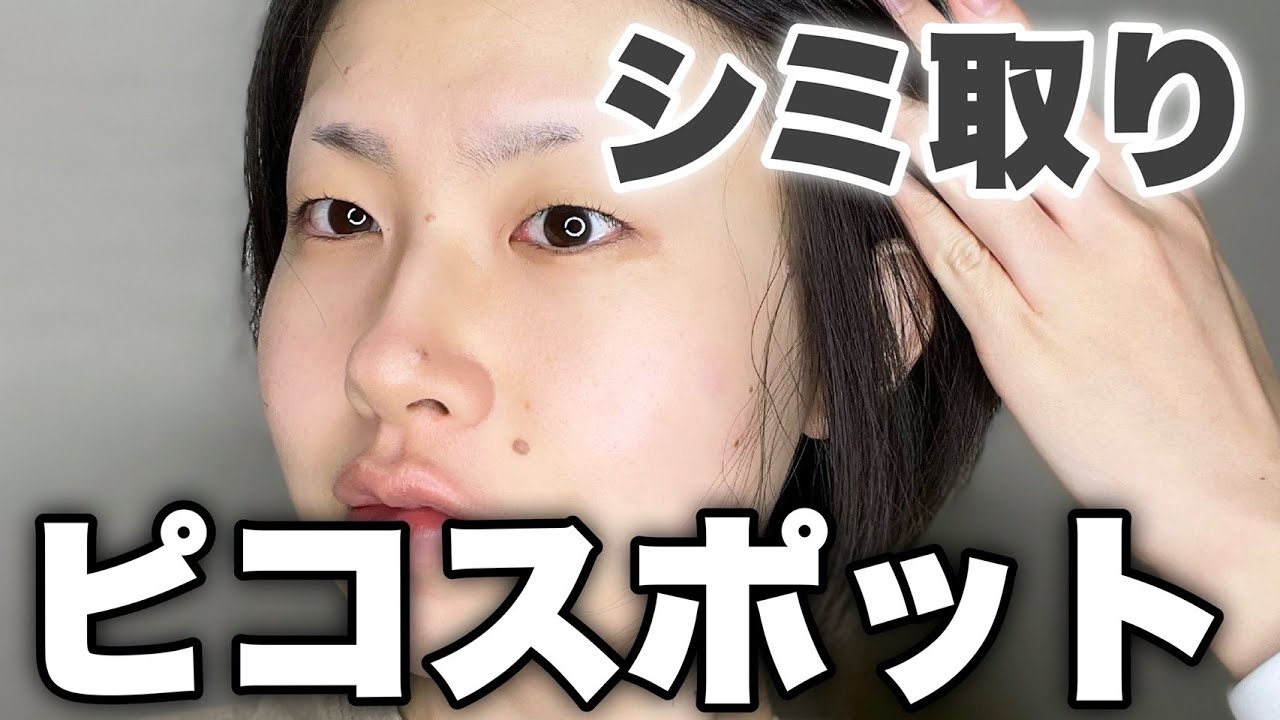 シミ取り】ピコスポット徹底解説｜before,after【後編】 - YouTube