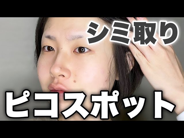 シミ取り】ピコスポット徹底解説｜before,after【後編】 - YouTube