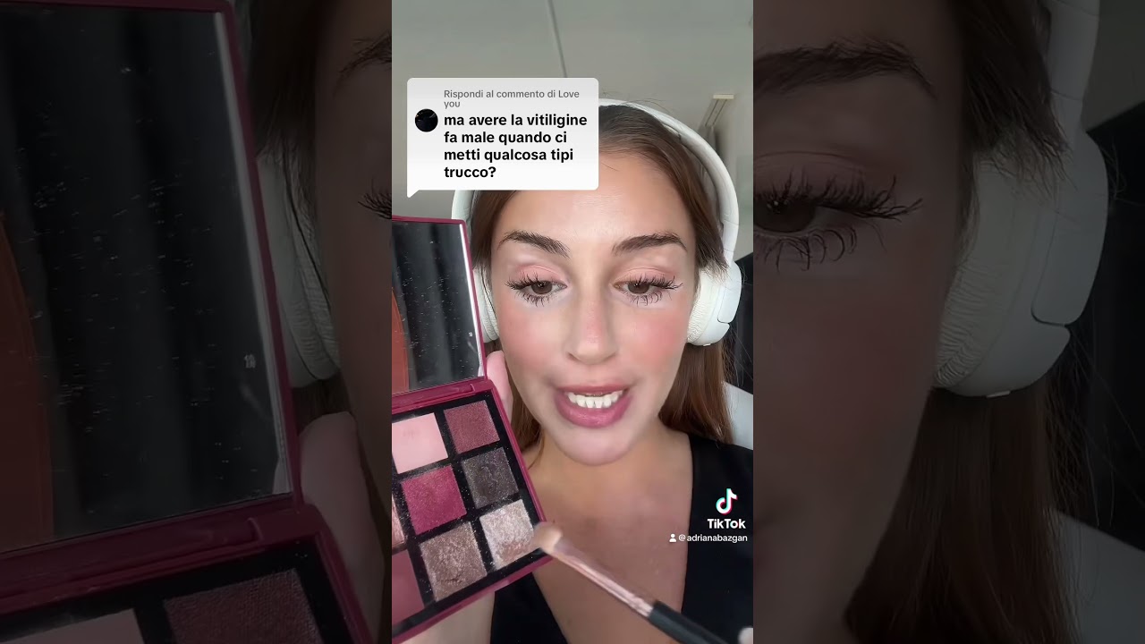 Che cosa succede alla vitiligine se ci metto il trucco ?