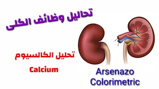 تحليل الكالسيوم Ca Total ( طريقة Arsenazo )   تعليم التحاليل الطبية للمبتدئين.