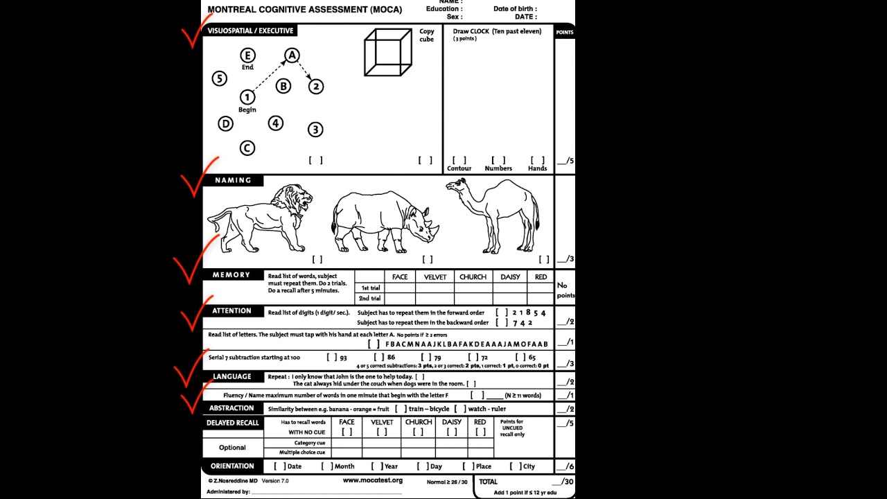 6 Montreal Cognitive Assessment Form Moca Youtube