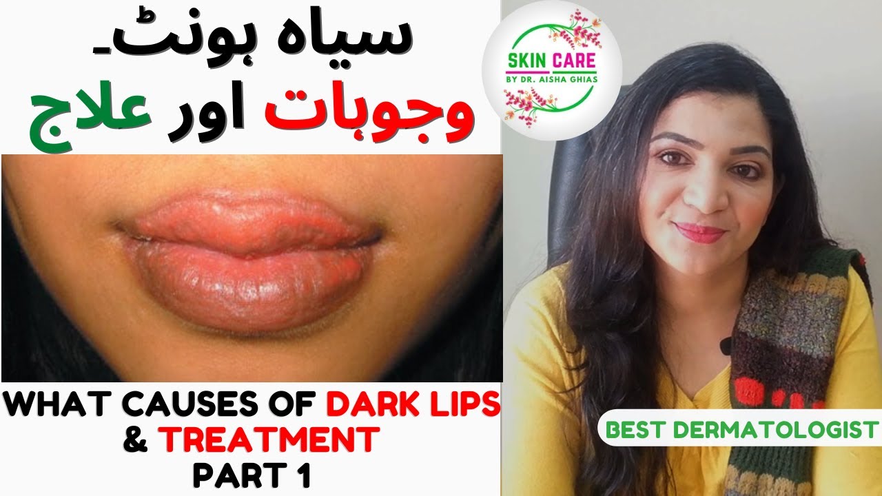 What Causes of Black Lips How many causes of Dark Lips in Detail Urdu