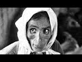The HORRIFYING History of Typhus