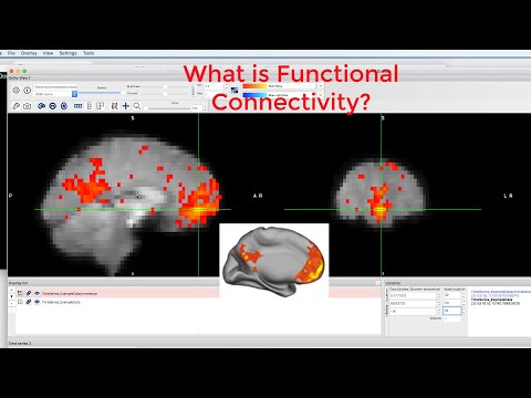 CONN Tutorial #1: What is Functional Connectivity?