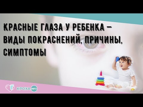 Красные глаза у ребенка — виды покраснений, причины, симптомы