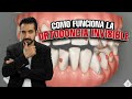 Cómo Funciona la Ortodoncia Invisible con Alineadores Invisalign I Tu Dentista de Confianza