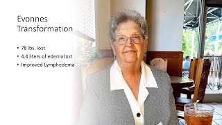 Evonnes story. 78 lbs lost and improved lymphedema at age 80