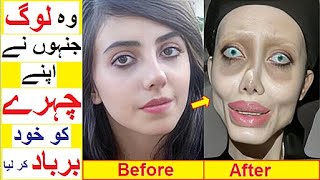 People Who Destroyed their Faces with Cosmetic Surgeries