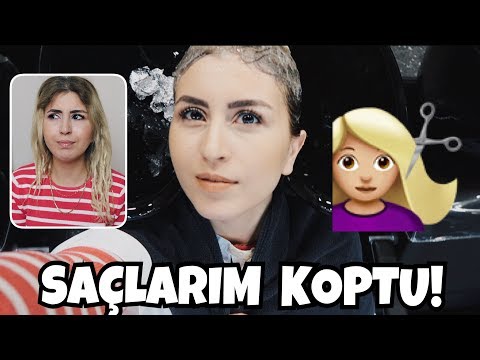 SAÇLARIM KOPTU!