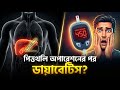পিত্তথলি অপারেশনের পর ডায়বেটিসের ঝুঁকি কি বেশি হয়? | Gallstones | Diabetes | (প্রশ্ন পর্ব -২০)