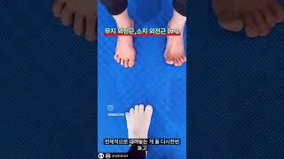 수술× 4기 무지외반증 교정운동 4가지#무지외반증교정운동 #핏프로 #바른걸음연구소37개지점 #재활운동 #무지외반증수술