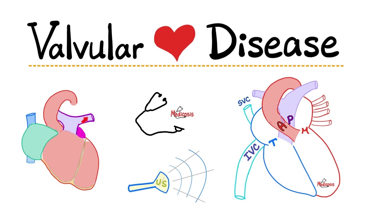 Valvular Heart Diseases (VHD) - An Introduction - Cardiology 🫀