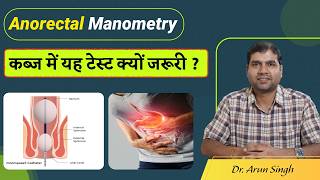 एनोरेक्टल मैनोमेट्री क्या है और कब्ज में कब की जाती है ? Anorectal Manometry in Constipation