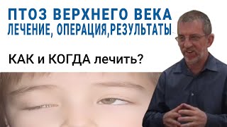 Птоз верхнего века у детей - Лечение, Операция, Результаты. Профессор Моррис Хартштейн (Израиль)