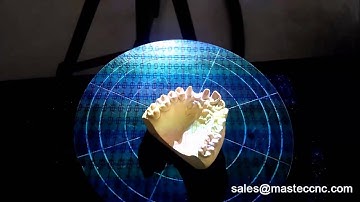 Dental Tooth Scanning by structured light 3d scanner with rotary table