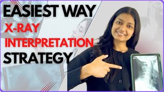 CERVICAL X-ray INTERPRETATION | PHYSIOTHERAPY EDITION