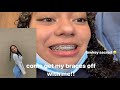 come get my braces off with me!! | Sierra Nichole