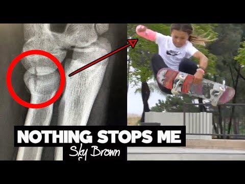 WHAT HAPPENED?! | Sky Brown 10 yr old Skater