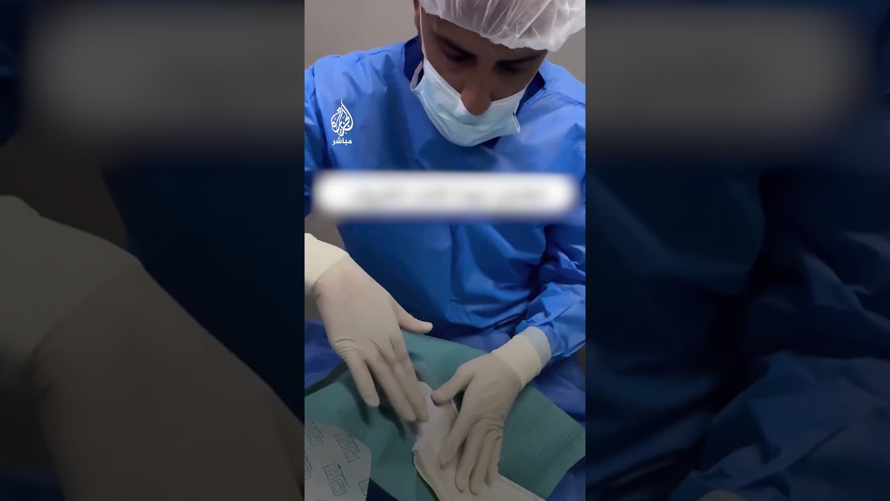 طبيب مصري في غزة يصنع مستلزماته يدويا لإجراء عملية جراحية بعد نفاد مخزونها في المستشفى الأوروبي