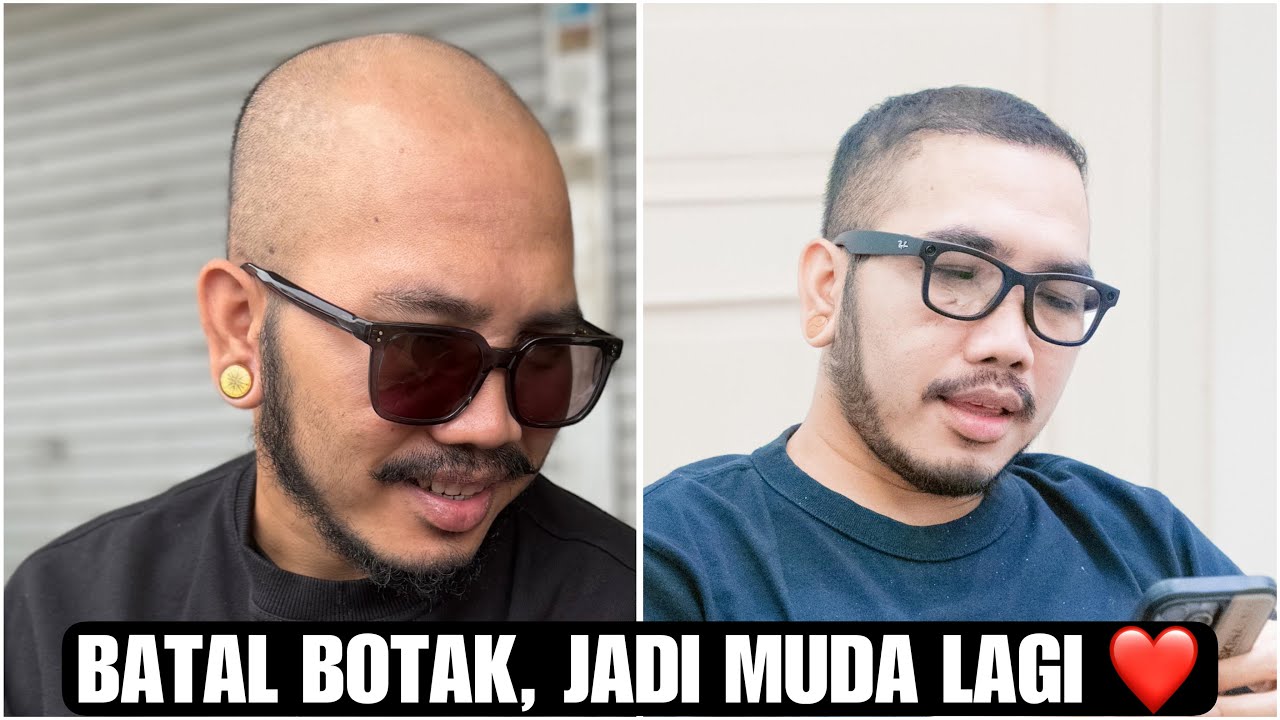 PROSES TANAM RAMBUT GUE DARI BOTAK SAMPAI HASILNYA. [Personal Vlog]