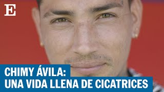 Chimy Ávila, ante la final de Copa del Rey: Una vida llena de cicatrices | EL PAÍS