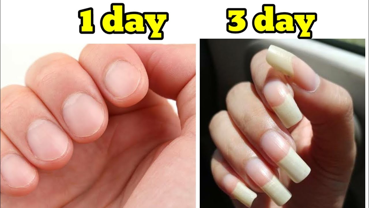 How to nail growth in 3 dayHow to grow your nails really fast in one