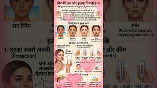 पिगमेंटेशन (झाइयां) को जड़ से कैसे खत्म करें? ✅ Pigmentation Treatment