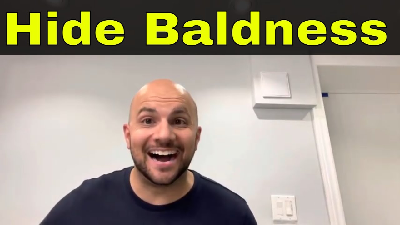 How To Hide Baldness Easily Things That Actually Work YouTube how-to-hide-baldness-easily-things-that-actually-work-youtube