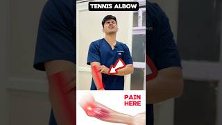 Tennis Elbowβ
#physiotherapy #rehabilitation #painrelief #doctor Tennis Elbowβ
#physiotherapy #rehabilitation #painrelief #doctor