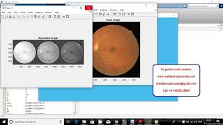 Optic Disc Localization in Retinal Images based on Cumulative Sum Fields