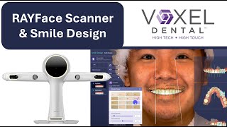RAYFace Scanner & Smile Design