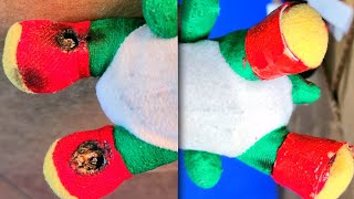 Shonie Boy Fixes Yoshis Feet