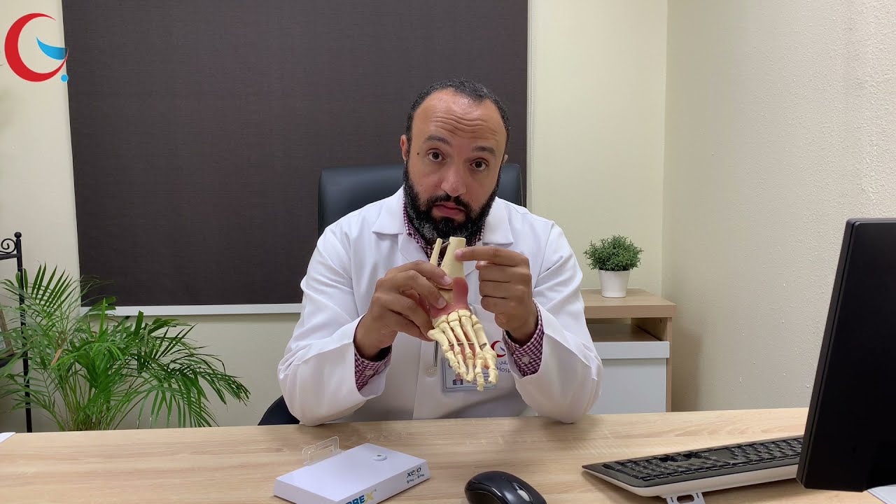 اورام العظام في الاطفال (تكيسات العظام)