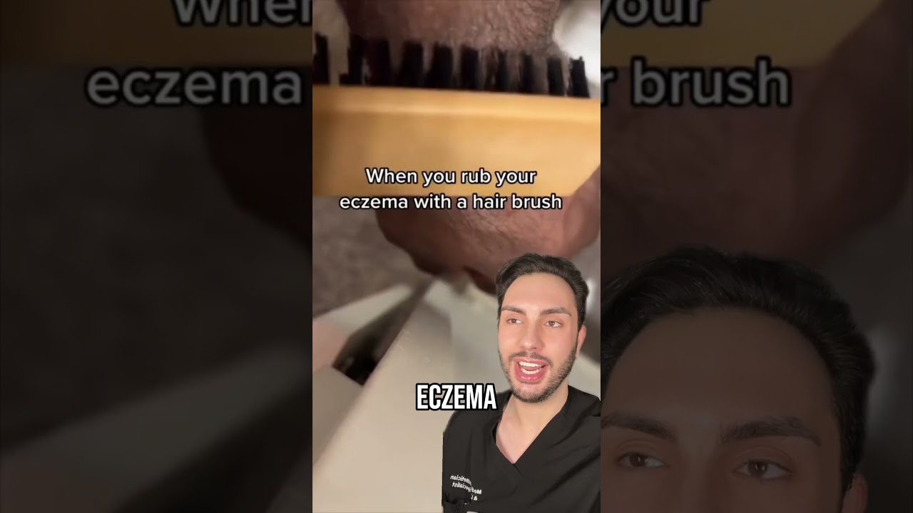 One Product To Get Rid Of Itchy Skin From Eczema, Bug Bites, Sunburn, and Poison Ivy | MaximumSkin