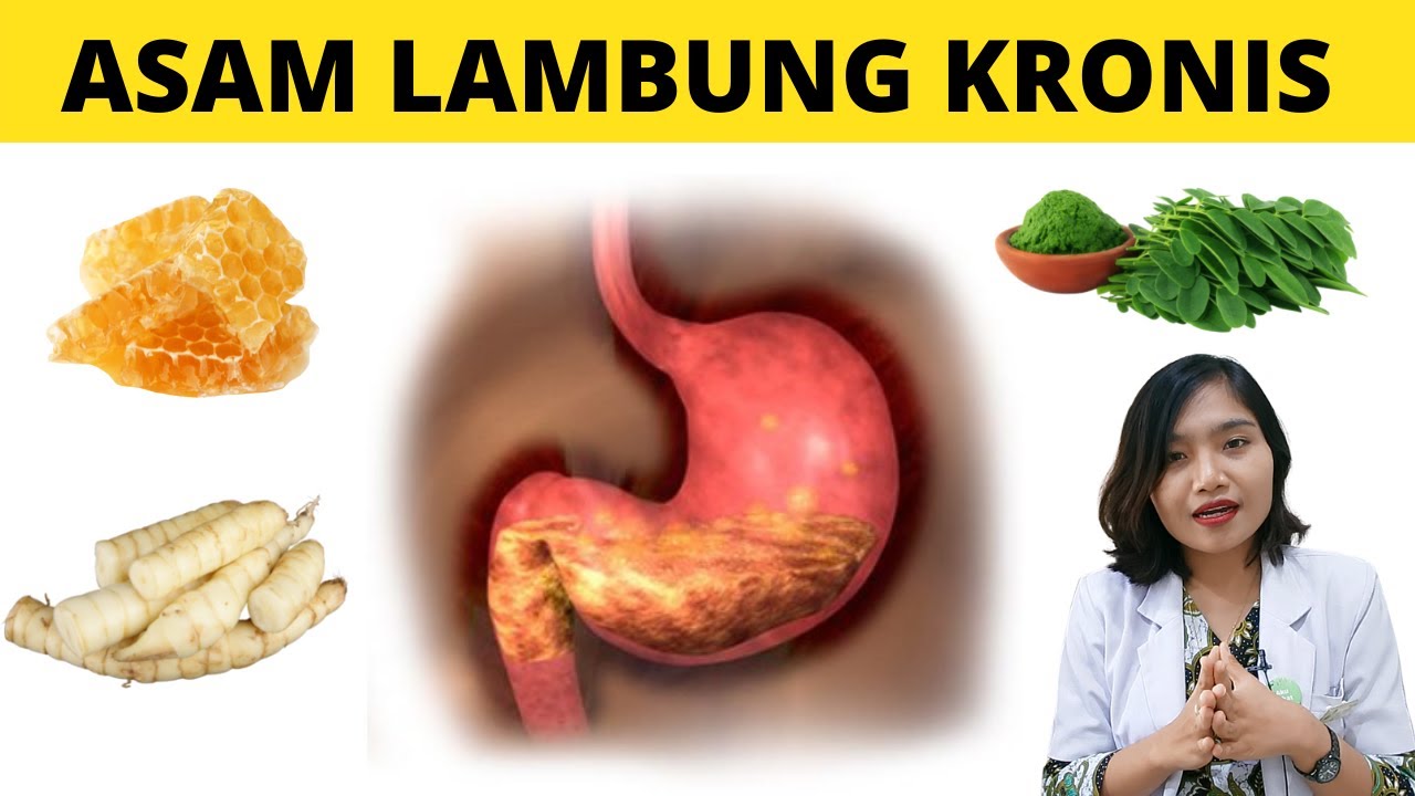 ЛУЧШАЯ ПИЩА ДЛЯ ЛЕЧЕНИЯ ЖЕЛУДОЧНОЙ КИСЛОТЫ